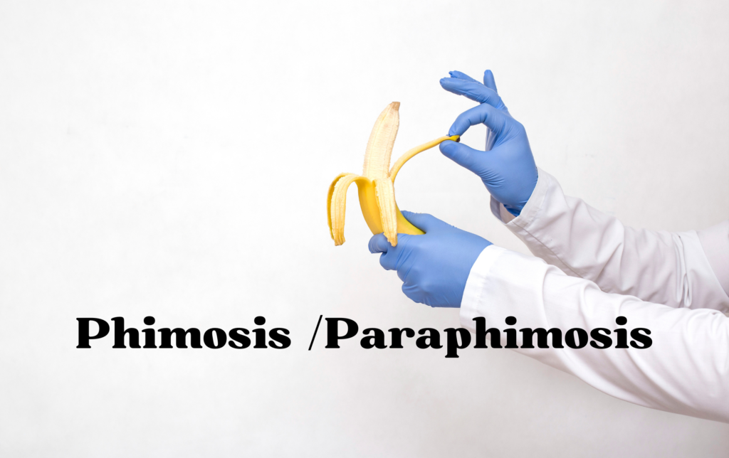 Phimosis /Paraphimosis