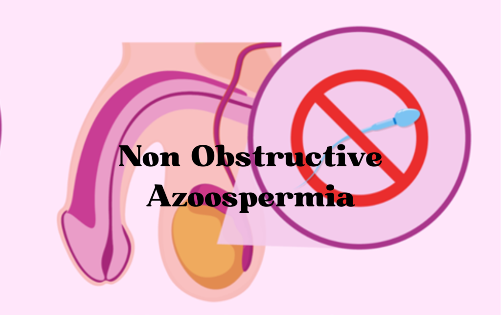 Non Obstructive Azoospermia