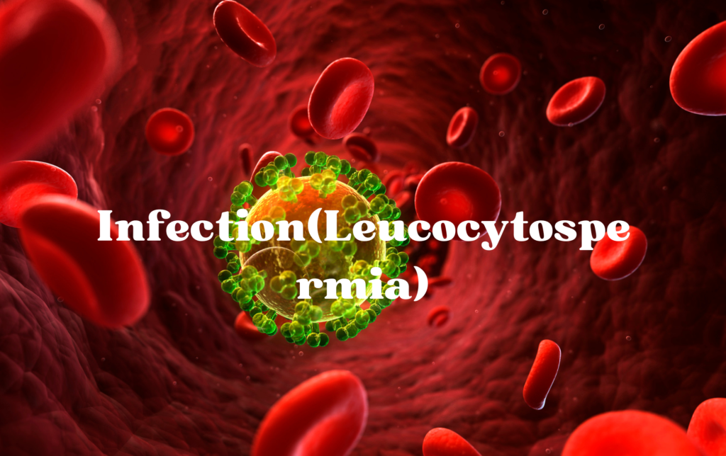 Infection(Leucocytospermia)