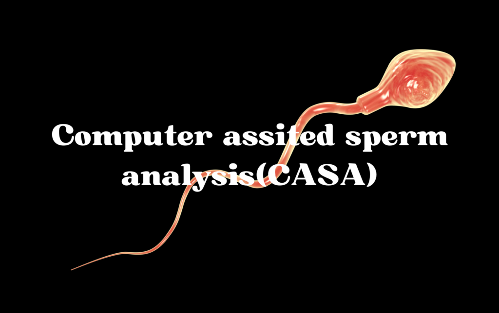 Computer assited sperm analysis(CASA)