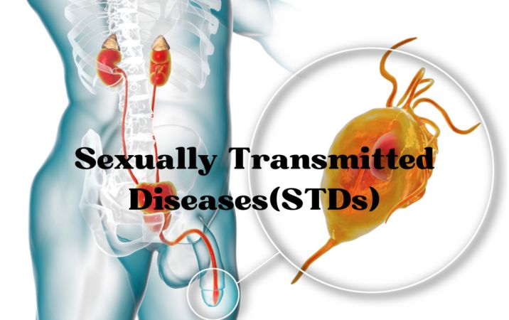 Sexually Transmitted Diseases(STDs)