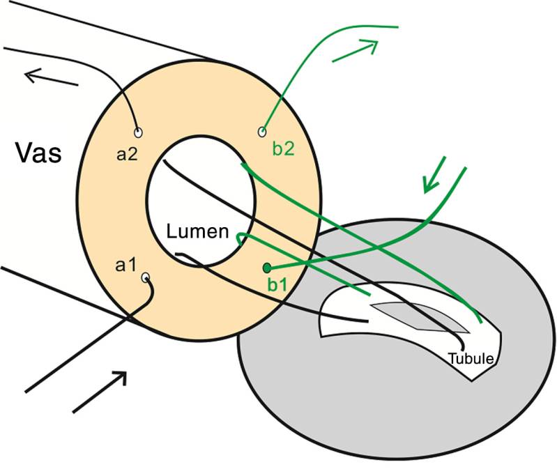 VasoEpididymal Anastomosis