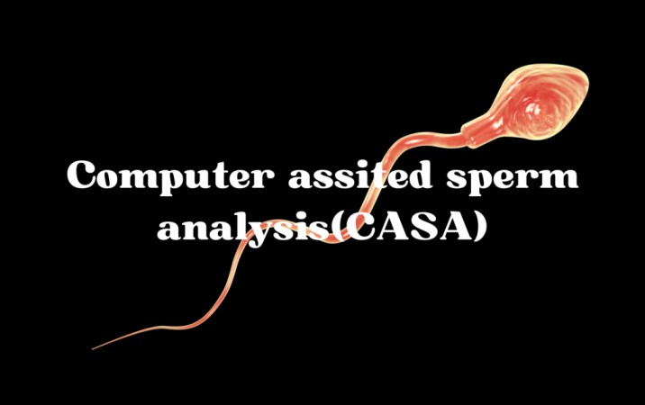 computer assisted sperm analysis