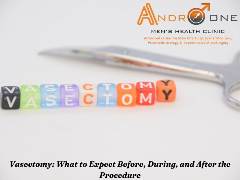 vasectomy