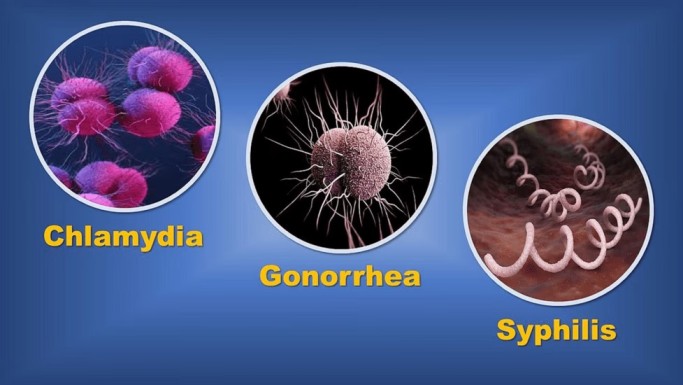 Can Infections Lower Sperm Count? The Link Between STDs and Infertility