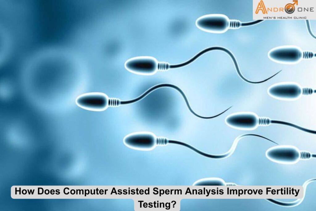 Computer Assisted Sperm Analysis