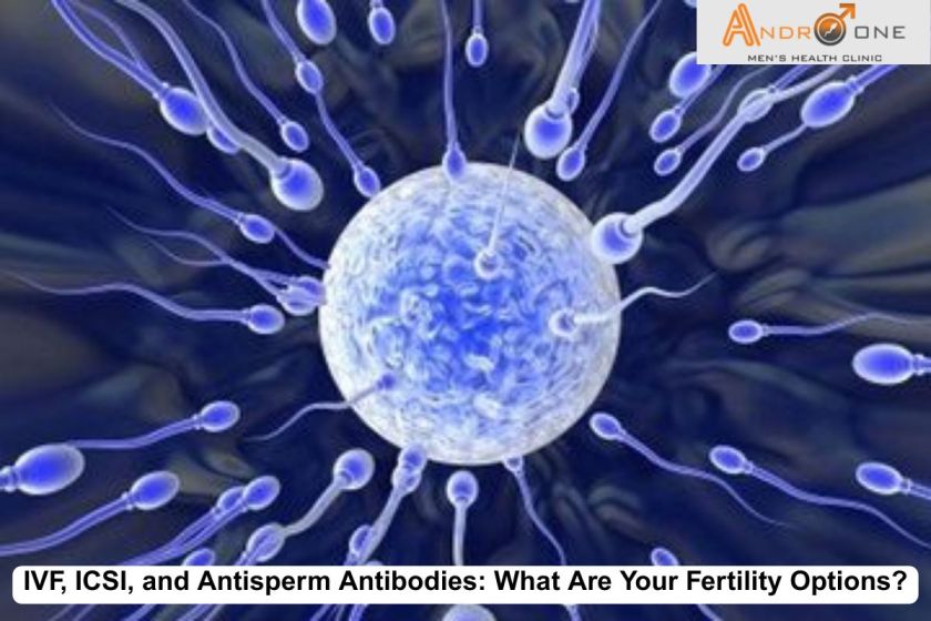 IVF ICSI and Antisperm Antibodies