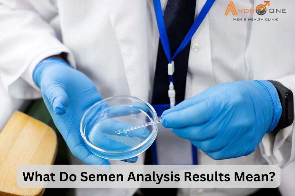 Semen Analysis