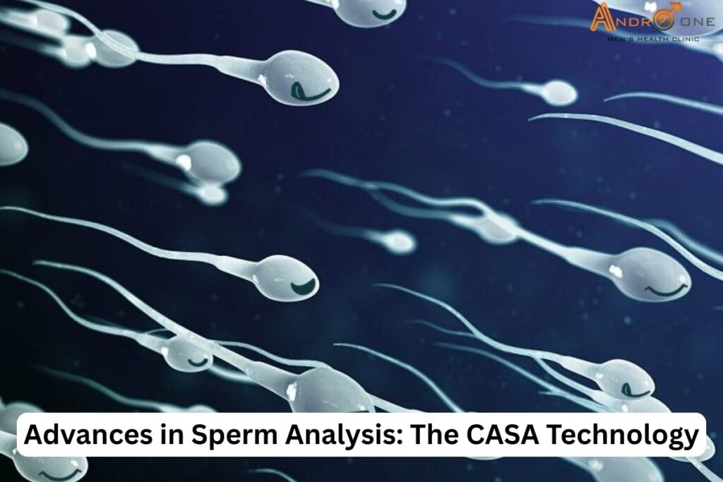 How CASA Sperm analysis