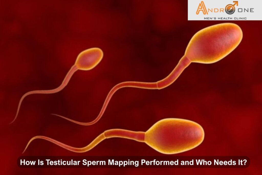 Testicular Sperm Mapping
